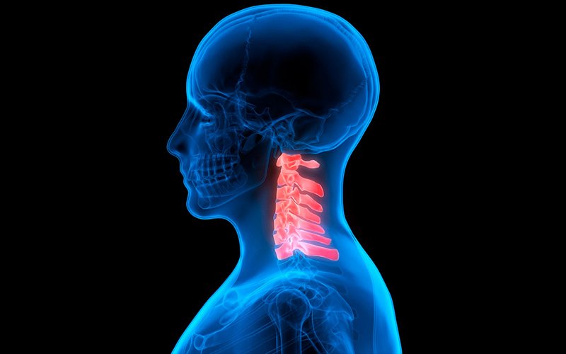 ACDF (Discectomia e artrodese cervical anterior)